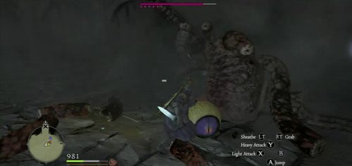 Try to focus on cutting the tentacles off - this will cause the Eye to fall to the ground to rest and will reveal its weak tissue - Fathom Deep - The Everfall - Act VII - Dragons Dogma - Game Guide and Walkthrough