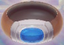 Power Bracelet - found inside the Bottle Grotto - Items in Links Awakening - Collectibles - Links Awakening Guide