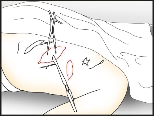 use rib spreader on the second cut and cut deeper with scalpel - Make a Dissection | Slaughter in Whitechapel - Slaughter in Whitechapel - The Testament of Sherlock Holmes Game Guide